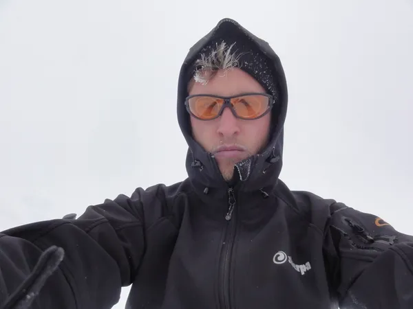 Die ersten grauen Haare spriessen